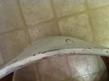 Sonor Teardrop Reconstructive Surgery-HELP!